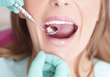 Endodoncia dental