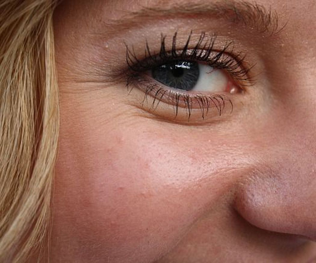 ¿Cómo afecta el sol a tu cara?