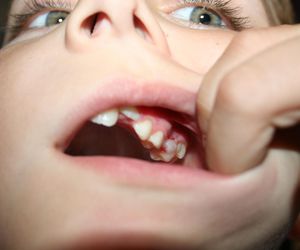 Odontología general a niños y adultos