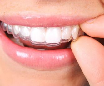 Higiene bucal: Tratamientos de Clínica Dental Dentimar