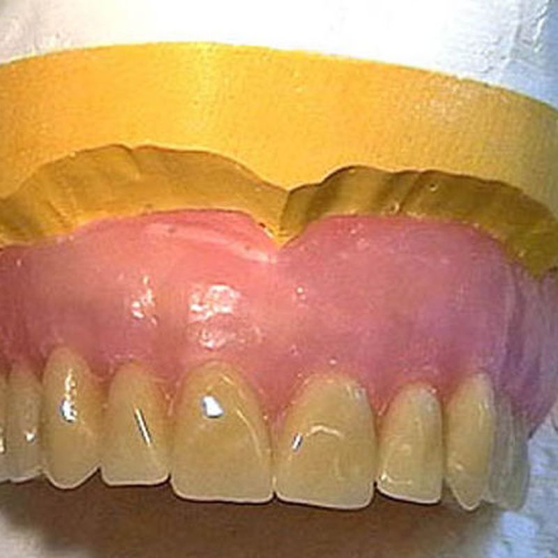 Prótesis dental fija: Tratamientos de Clínica Dental Dr. de la Torre