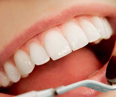 Odontología estética para lucir unos dientes perfectos