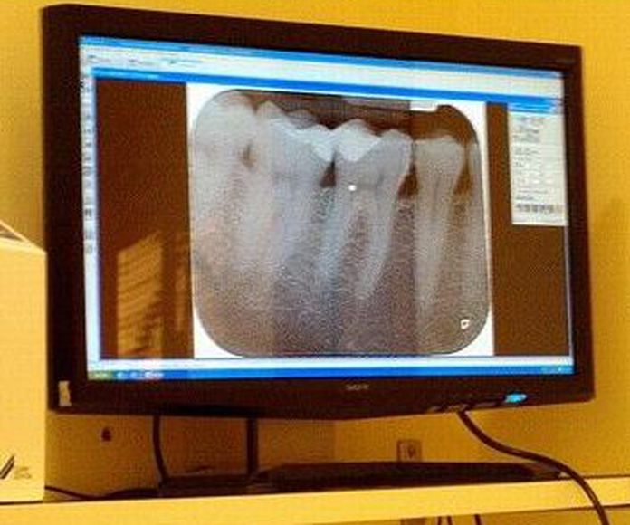 Ortodoncia: Tratamientos de Dential