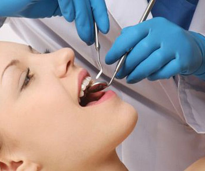 Implantología: Especialidades de Clínica Dental Plaza 58 (Dr. Pedro Fernández Lorente) }}