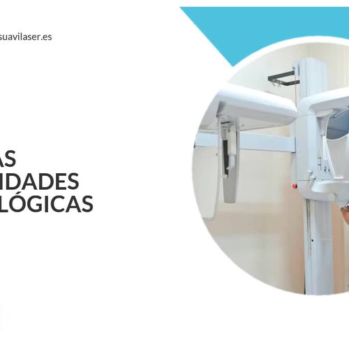 Implantes dentales Madrid Centro