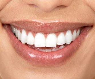 Estética dental: Servicios de Clínica Dental Safident
