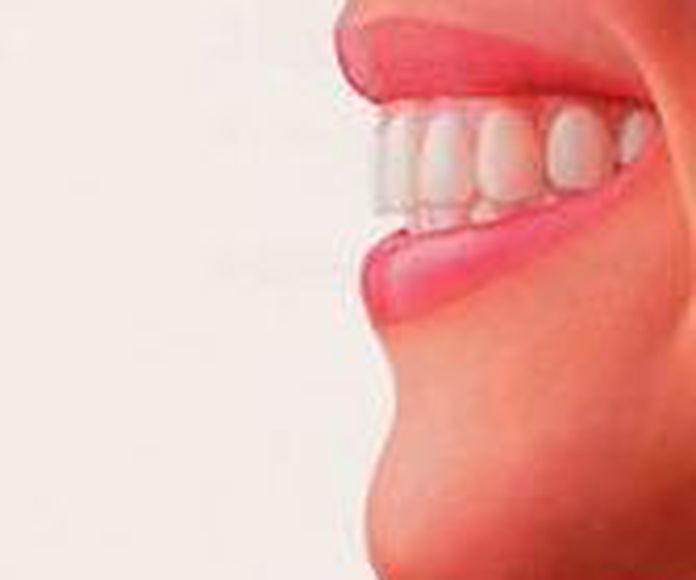 Ortodoncia: Servicios de Clínica Dental El Carmen