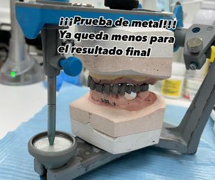 Prueba de metal
