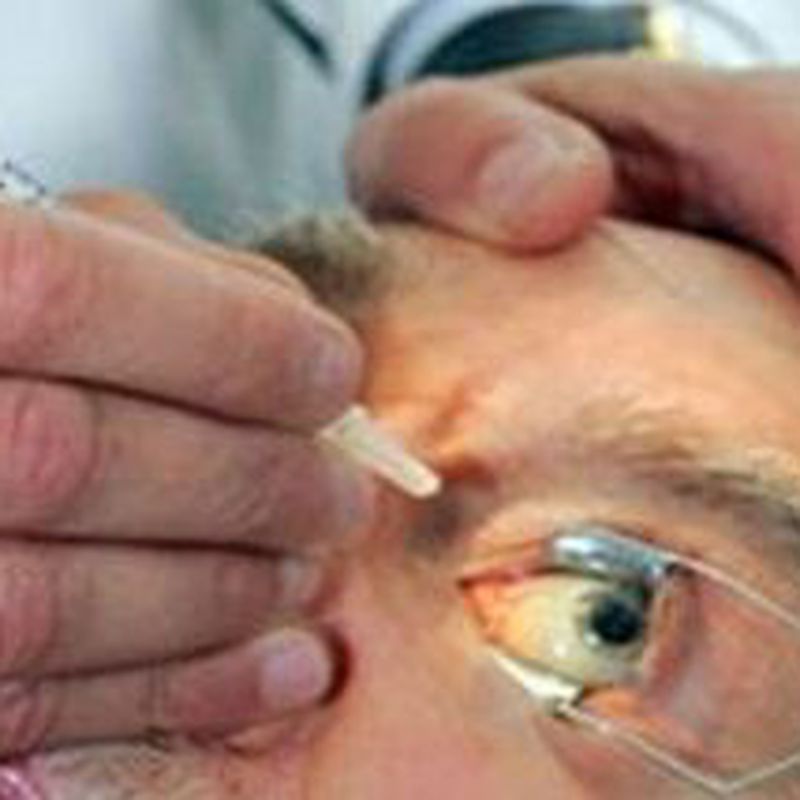 Trombosis venosa retiniana : Patologías oculares de Oftalmólogo Cristina Mantolán Sarmiento