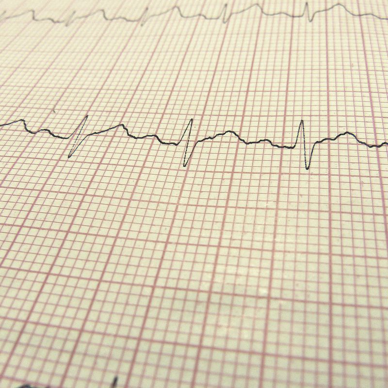 Electrocardiograma: Servicios de Vetalliance Reus Clínica Veterinaria