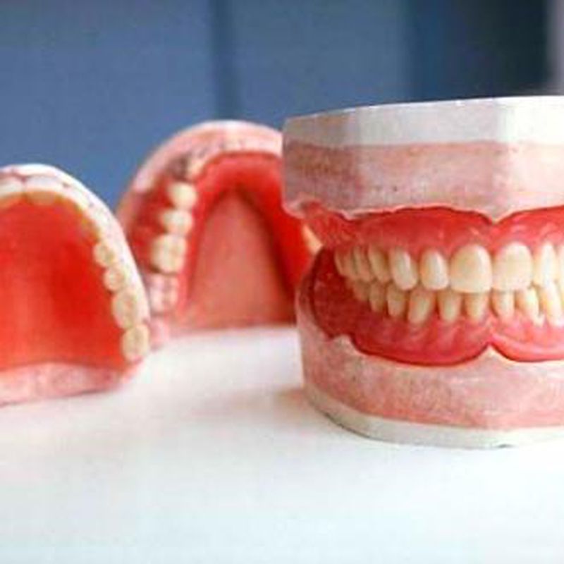 Protesis removible: Tratamientos de Hospident Clínica Dental