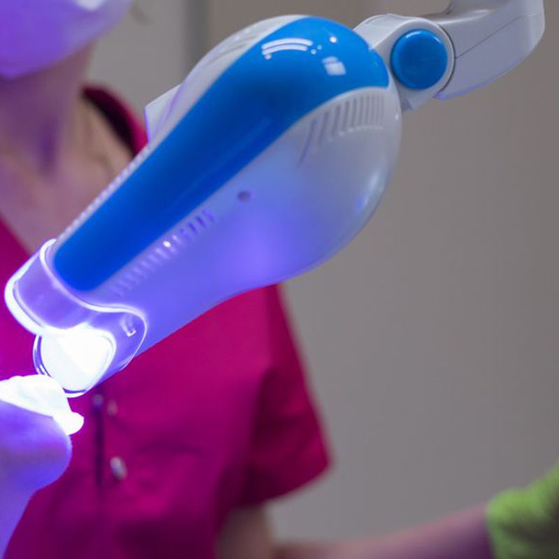 Blanqueamiento dental: Tratamientos de Clínica Dental Palamadent