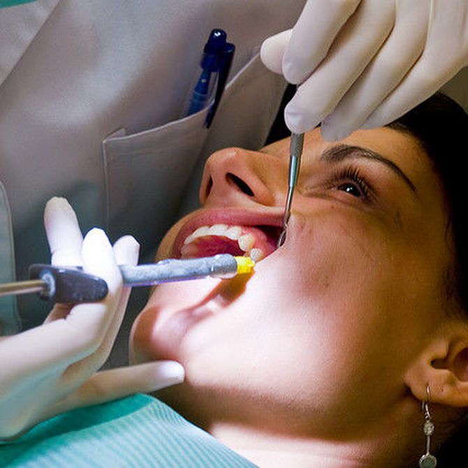 Consejos para el cuidado de los implantes dentales