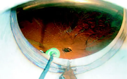 Imagen 5 de la galería