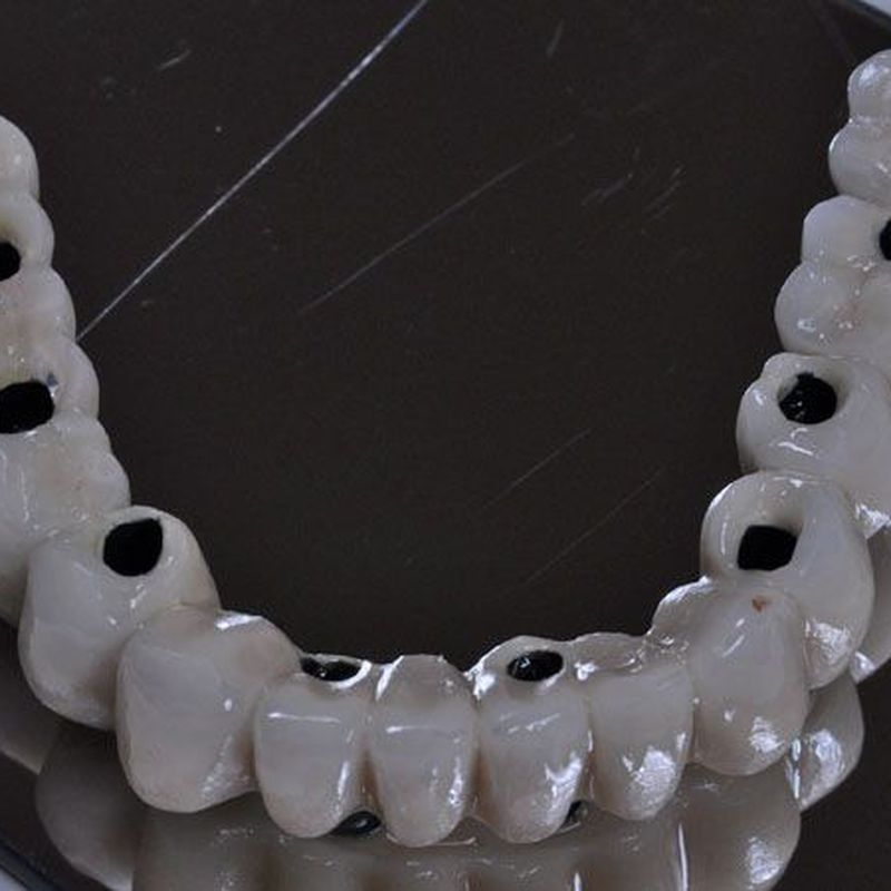Implantes: Servicios de Clínica Dental Dra. Esther Blánquez