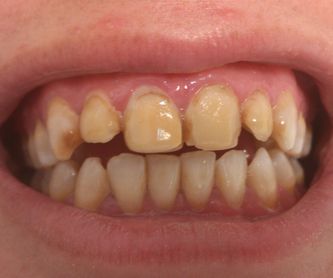 Periodoncia: Tratamientos de Clínica Dental Tucán
