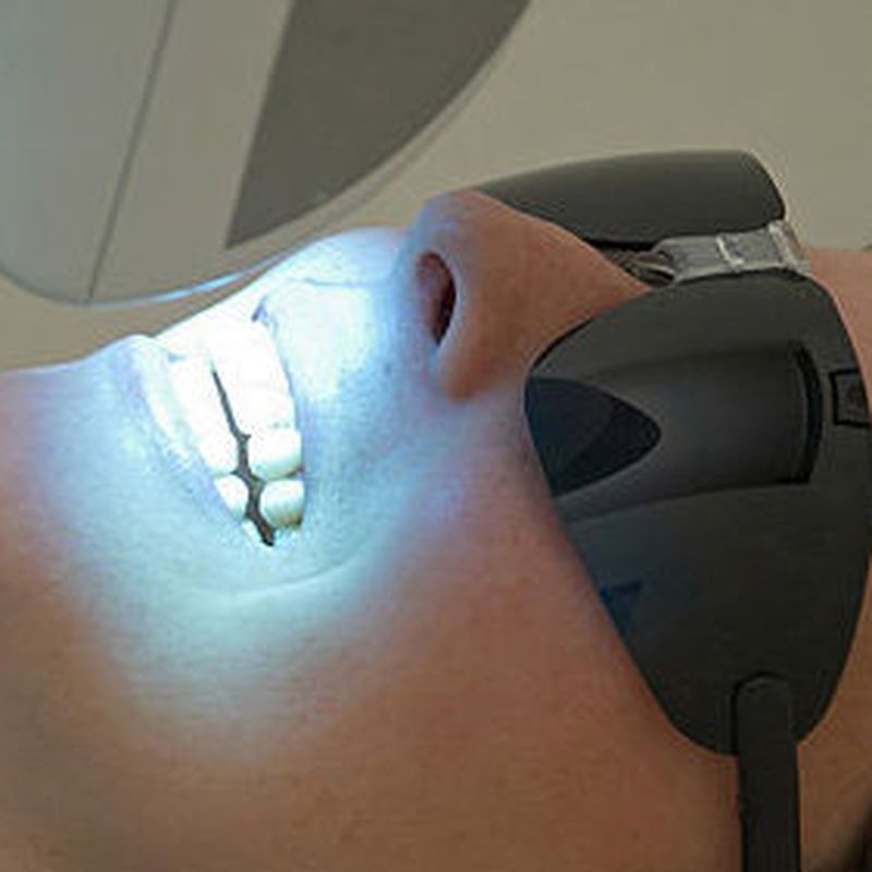 Blanqueamientos dentales: Tratamientos de Clínica Dental Dr. de la Torre