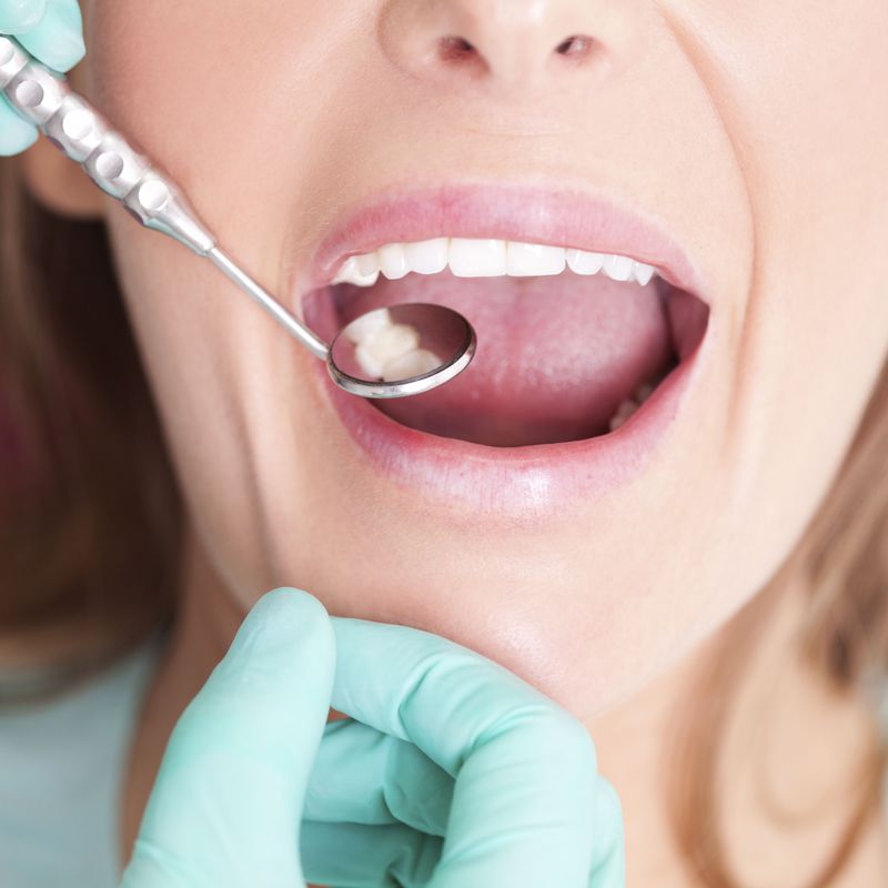 Periodòncia: Tractaments de Clínica Dental Santa Marta