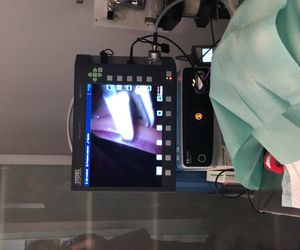 Esterilización de una perra por técnica de laparoscopia en centro veterinari huellas
