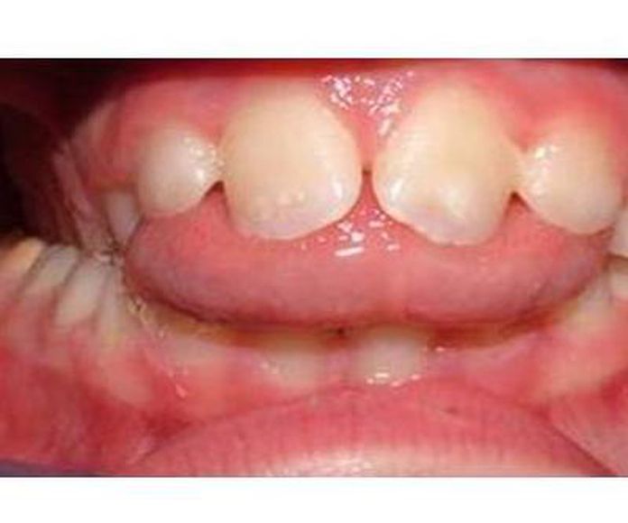 Trastornos funcionales dentofaciales: Servicios de Clínica Foniatría - Logopedia Doctora Fernández Salazar