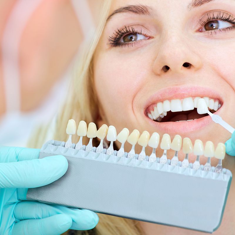 Carillas Dentales: Servicios de Clinica Dental Garó