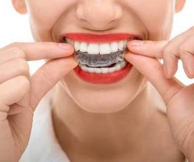 8 razones para llevar ortodoncia.