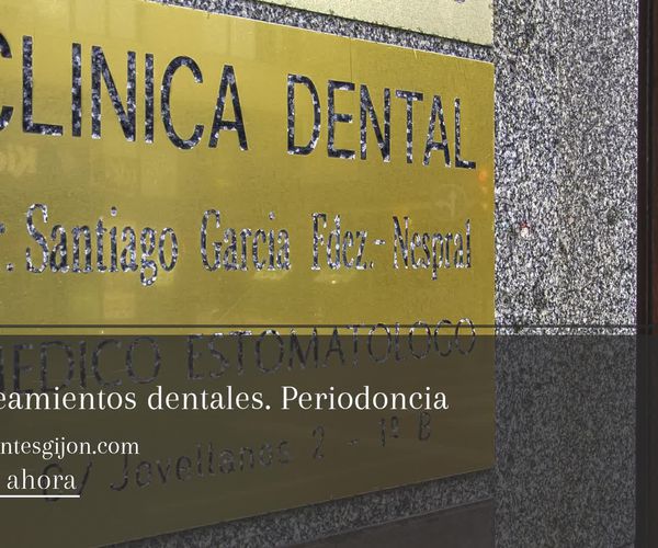 Implantes dentales en Gijón | Clínica Dental Santiago G. Fdez. - Nespral