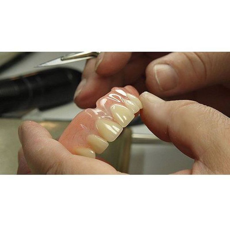 Prótesis dental: Tratamientos dentales de MARÍA JOSÉ CLOLS FERRER