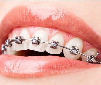 Prevención: Tratamientos de Centro Dental Europa