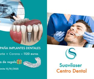 Campaña implantes dentales