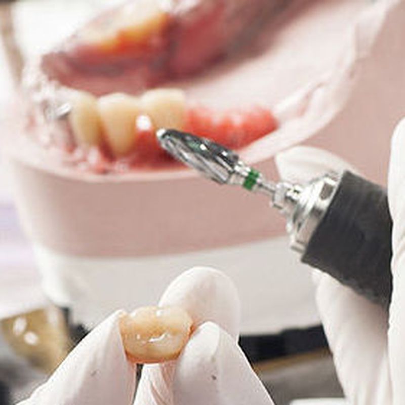 Cirugía maxilofacial: Tratamientos de Clínica Dental Dr. de la Torre