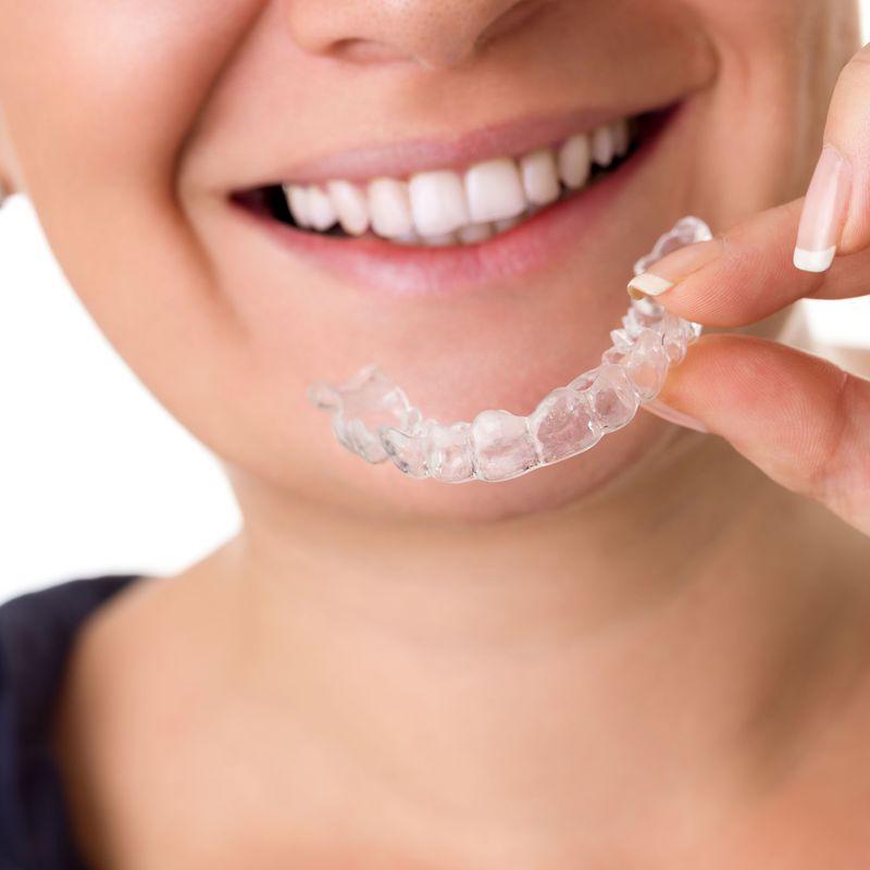 Invisalign®: Ortodoncia de Isabel Perales Clínica Dental