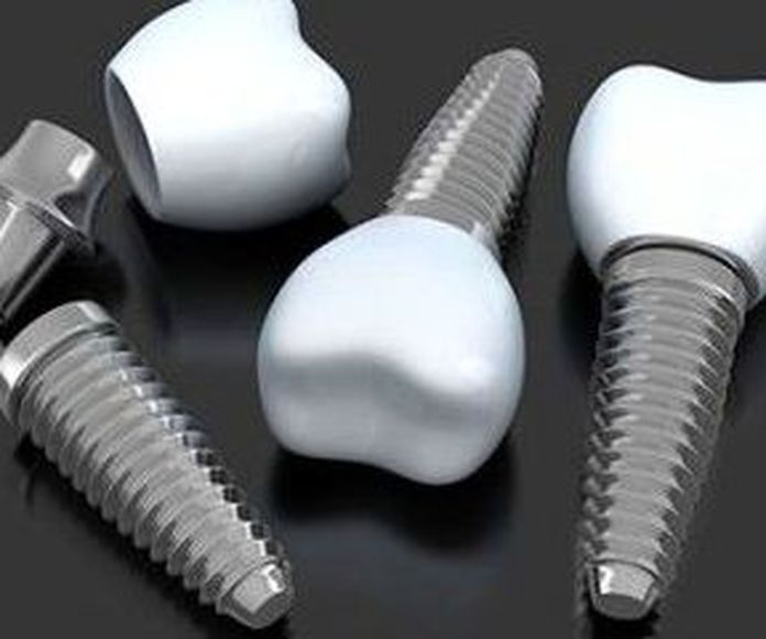 implante de dientes en Palamós
