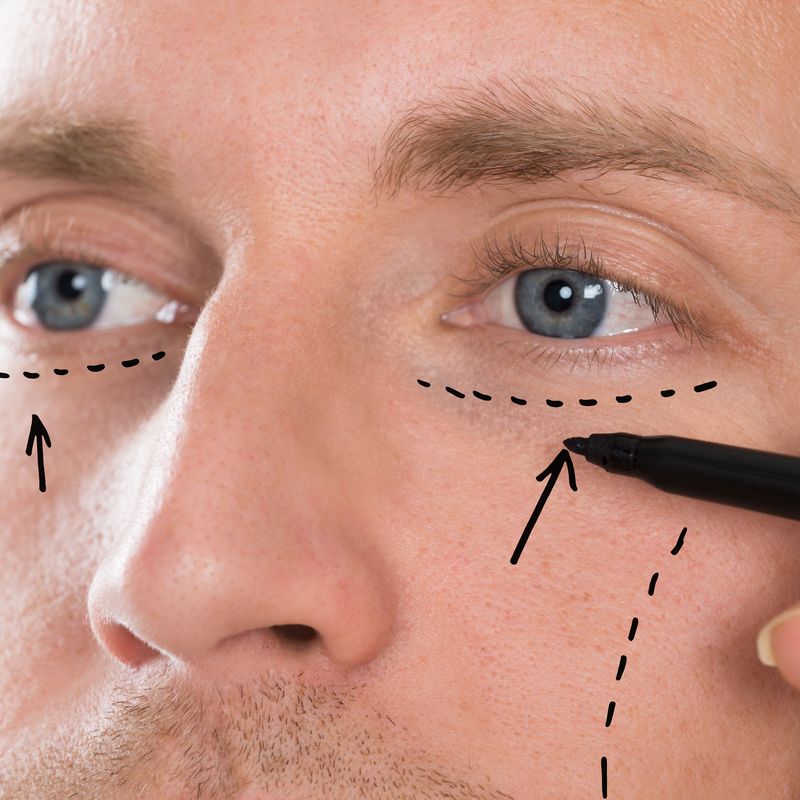 Corrección de arrugas con infiltraciones: Tratamientos y dietas de Clínica Rubigar