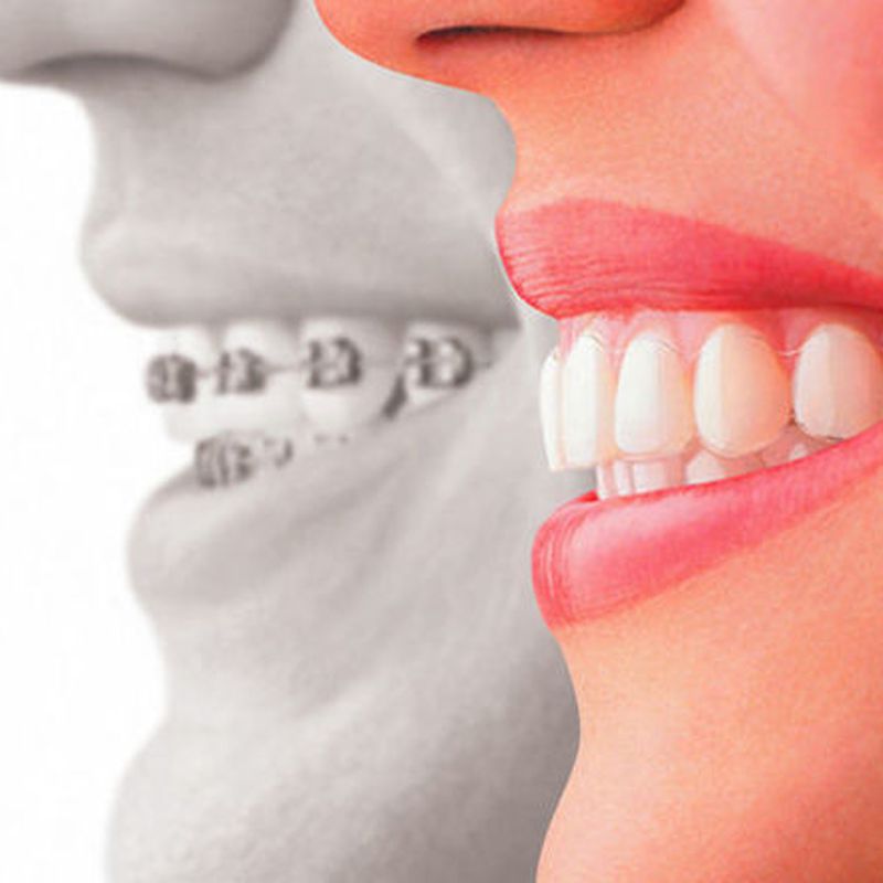 Estética dental: Tratamientos de Clínica Dental Dr. de la Torre