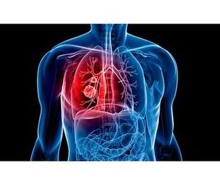 Enfermos con patología pulmonar