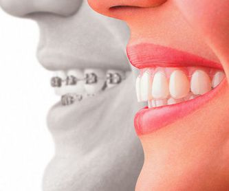 Prótesis dental removible: Tratamientos de Clínica Dental Dr. de la Torre