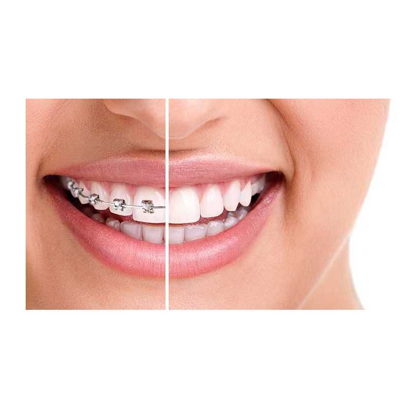 Ortodoncia: Servicios de Dental Implantes