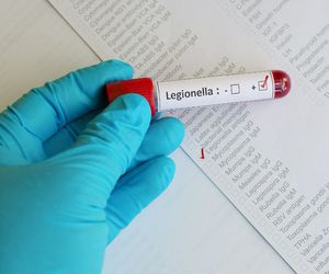 ¿Cómo evitar la infección por Legionella?