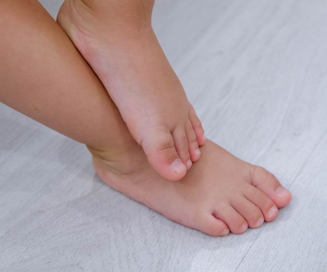 Cómo corregir los pies planos