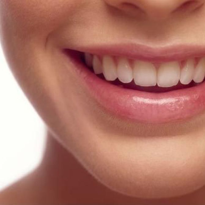 Beneficios de las prótesis dentales fijas