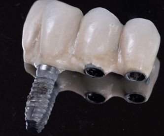 Ortodoncia estética: Tratamientos de Clínica Dental Palamadent
