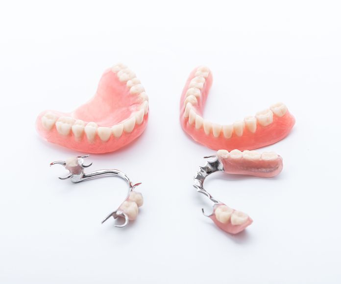 Prótesis dentales: Tratamientos de Clínica Dental Morilla