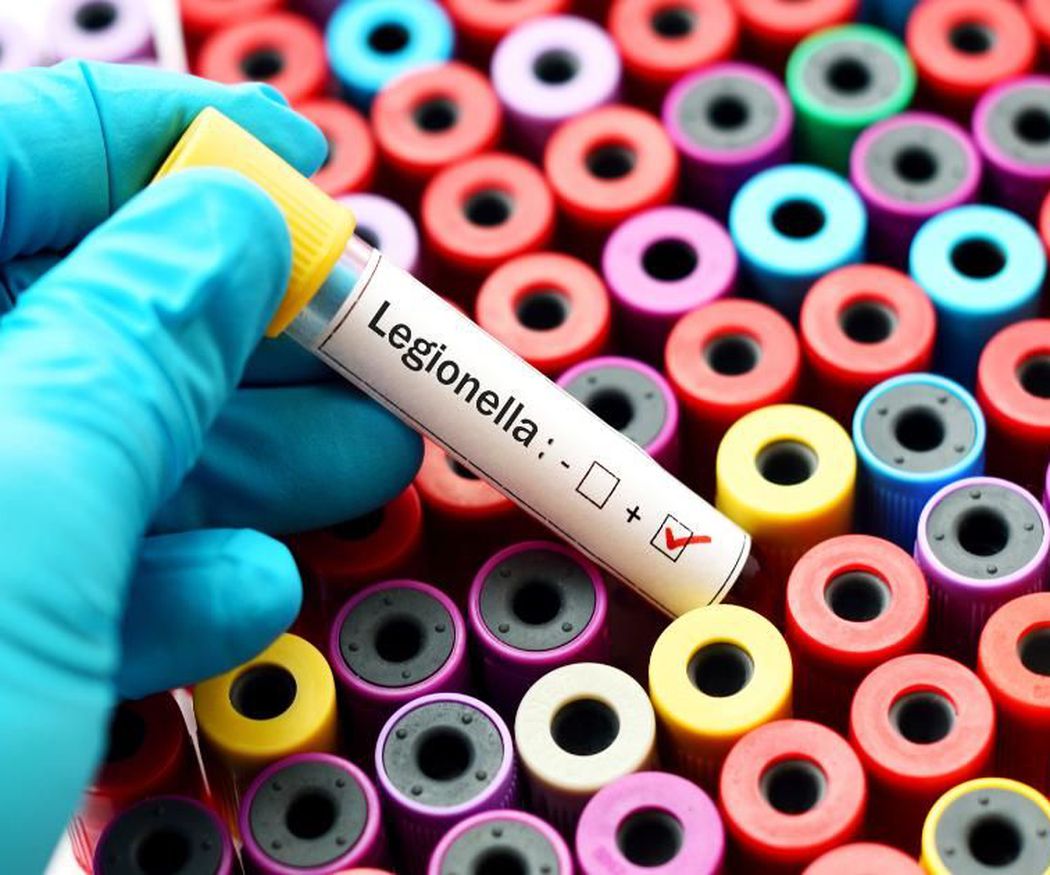 El caso más grave de Legionella en España