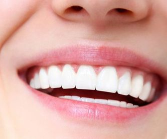 Especialistas en implantes dentales: Servicios de Clínica Sasermed Dental Buhaira