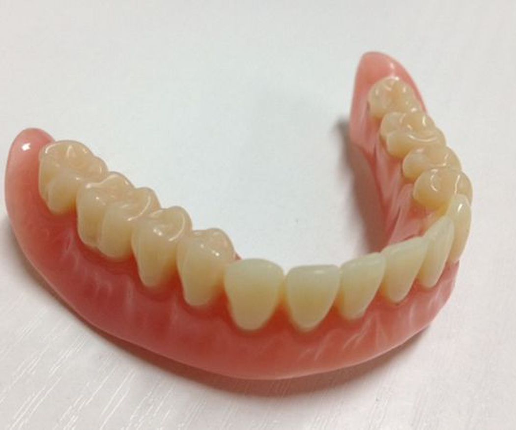 Clases de prótesis dentales más demandadas