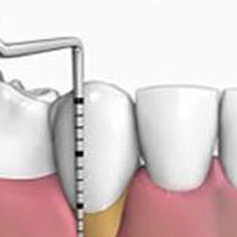 Periodoncia: Tratamientos de Clínica Dental Tucán