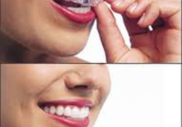 Invisalign