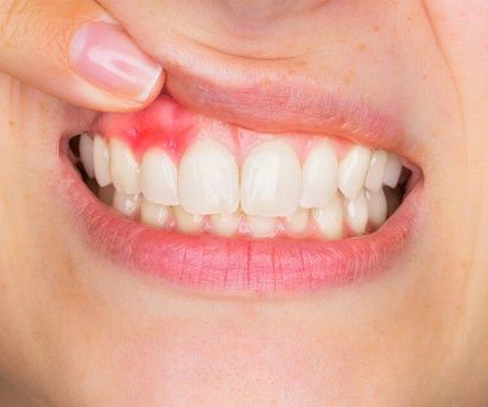 Periodoncia: Tratamientos de Clínica Dental Ruiz Jalón