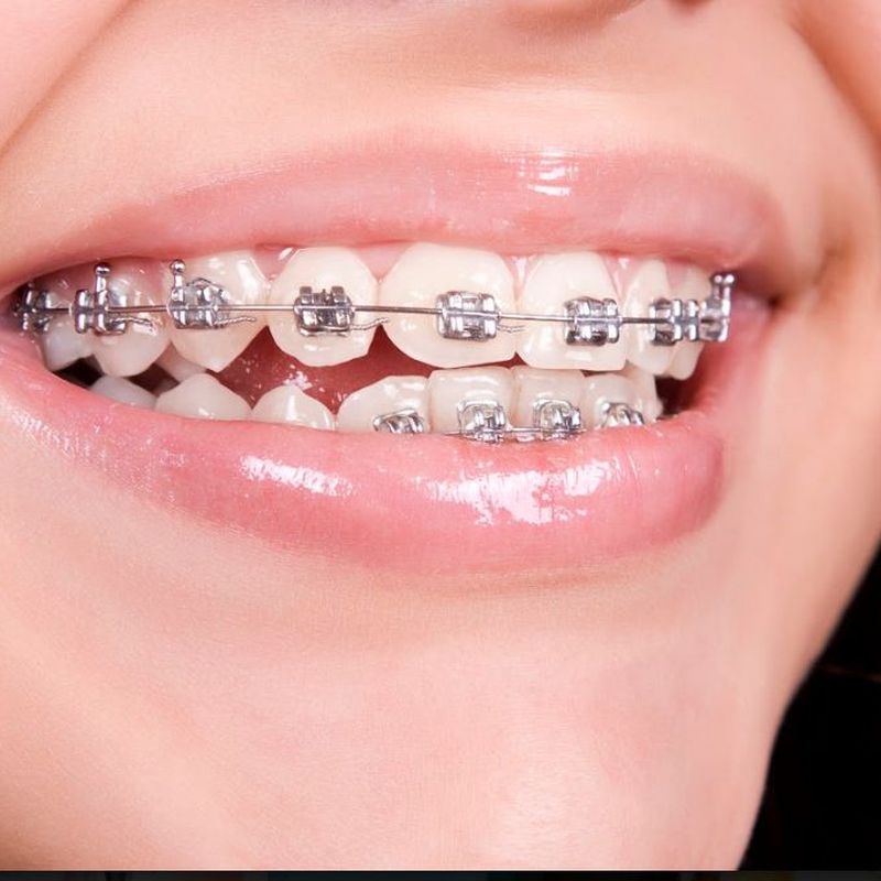 Ortodoncia: Servicios de CEO Clínica Dental
